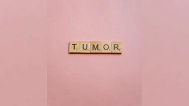 Health News | Researchers Reveal Level of Copper in Tumor Cells