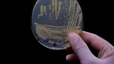 Health News | New Research Reveals Relationship Between Oral Bacteria and Diseases