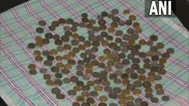 Karnataka Shocker: Doctors Remove 187 Coins From Man's Stomach at Hanagal Shree Kumareshwar Hospital and Research Centre in Bagalkot (Watch Video)