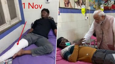 Patients Planted During PM Narendra Modi’s Morbi Civil Hospital Visit? Gujarat Government Clarifies on Two Viral Pictures of Same Patient One With Small Bandage and Another With Above-Knee Slab