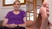 Woman With World's Largest Feet Holds The Guinness World Record For Shoe Size 18! Watch Video of US Woman Tanya Herbert