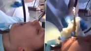 Snake in Woman&rsquo;s Mouth: Doctors Remove Four-Feet-Long Serpent That Slithered Down Her Throat While Sleeping (Graphic Video Warning)