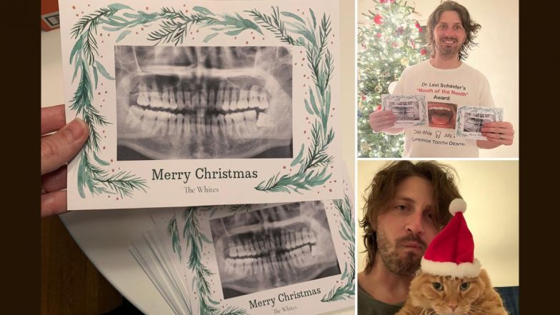 Christmas Disaster? California Man Accidentally Prints Neighbour’s Dental X-Rays on 90 Xmas Cards; View the Result Here