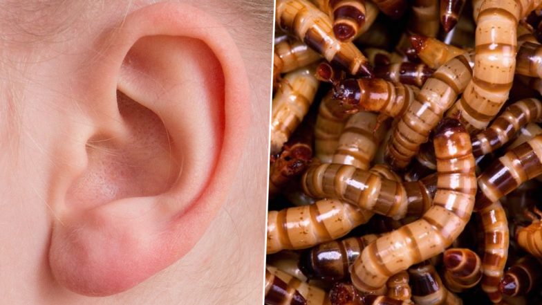 Flesh-Eating Maggots Found Living in Man's Ear Canal, Gets Hospitalised As The Infested Larvae Cause Pain & Bleeding (Watch Video)