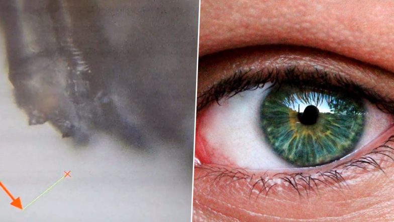 Worm-Like Creatures Living on Eyelashes! Man Films Horrifying Mites Entwined in Lash; Video May Leave You Feeling a Bit Yuck