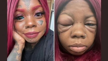 Woman Tattoos Her Eyeballs Purple and Blue! Northern Ireland-Based Woman Says She Might Be Losing Her Eyesight, Should Have Listened to Daughter (View Tweet)