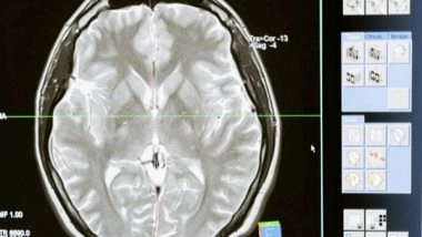 Science News | Silent Synapses Are Abundant in the Adult Brain: Study