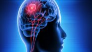 Science News | Study Explores Better Ways to Measure Cognitive Change in People with Intellectual Disability