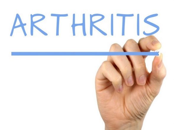 Health News | Study: Risk of Heart Disease Can Be Reduced by Rheumatoid Arthritis Medicine - Vimarsana News