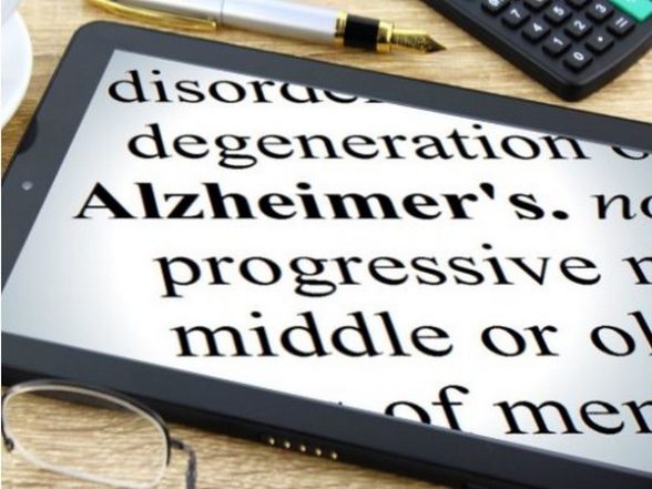 Health News | Researchers Map Deep Brain Stimulation Target for Alzheimer's Disease - Vimarsana News
