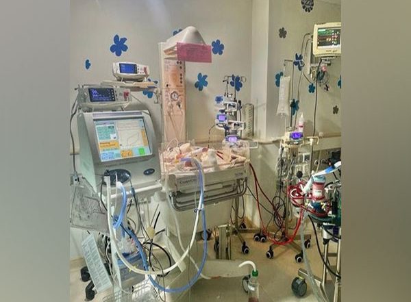Business News | Manipal Hospital Old Airport Road Successfully Carried out Bedside ECMO in Neonatal ICU, Saves Smallest Low Birth Weight Newborn Baby