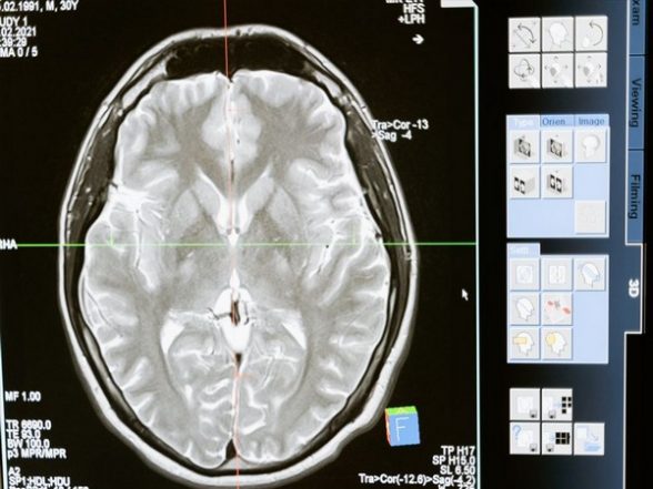 Science News | Research: Network Neuroscience Theory Best Predictor of Intelligence - Vimarsana News