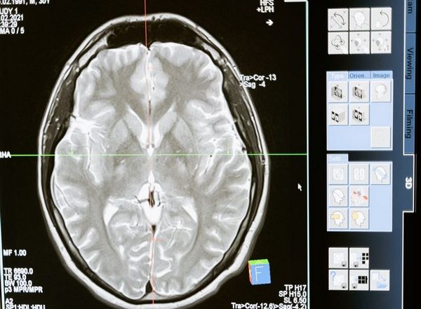 Science News | Research: Network Neuroscience Theory Best Predictor of Intelligence