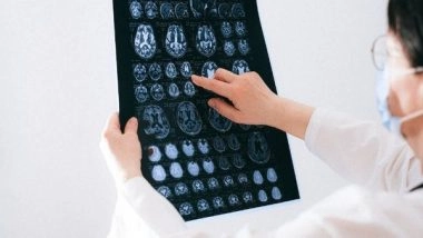 Science News | Study Reveals Genetic Risk for Dementia Among People of African Descent