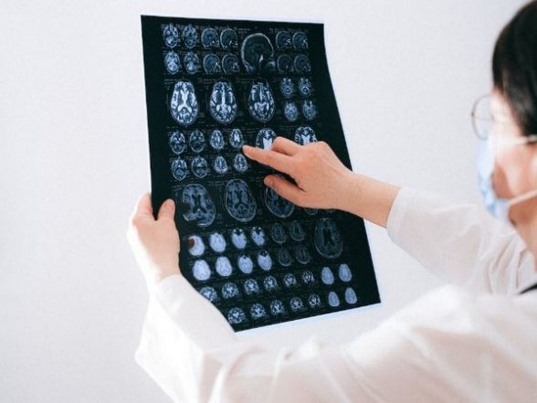 Science News | Study Reveals Genetic Risk for Dementia Among People of African Descent - Vimarsana News