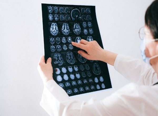 Science News | Study Reveals Genetic Risk for Dementia Among People of African Descent