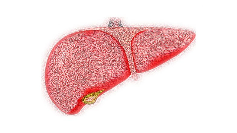 Hyderabad: Doctors Remove 12 kg Liver From 50-Year-Old Woman, Perform Kidney Transplant at KIMS Hospital