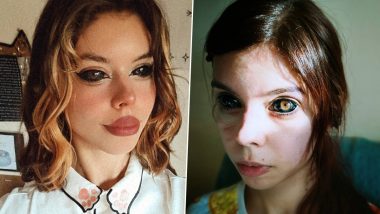 Woman Left Blind After Her Eyeballs Were Inked Incorrectly in Poland; Court Throws Fine on Tattoo Artist Responsible for the Horrific Job! (See Pics)