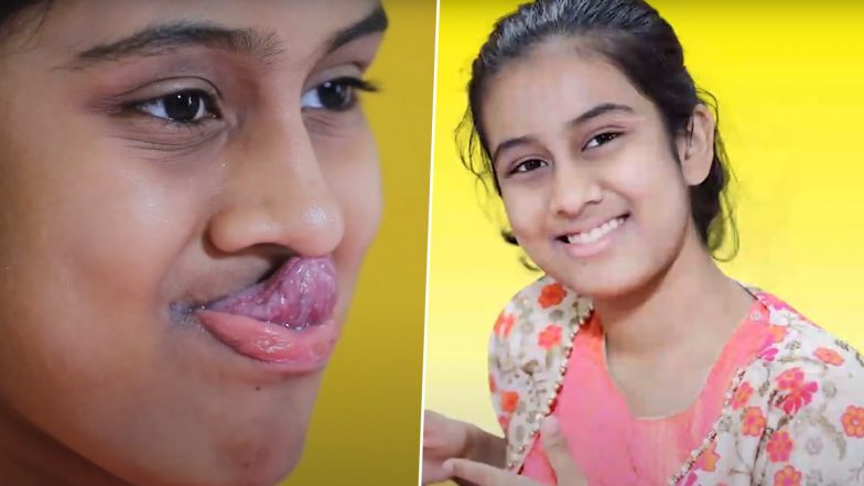 Karnataka: 14-Year-Old Girl From Bengaluru Sets Asian Record For Touching Nose With Tongue (Watch Video)