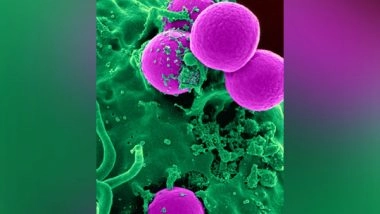 Health News | Research Reveals Cancer Threat from Virus Protecting Enzymes