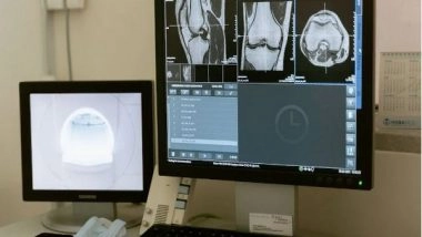 Health News | Japanese Research Reveals Physical Strain Helps Bone Growth