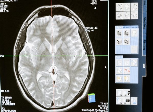 Science News | Scientists Shed Light on Brain's Ability to Perceive Space Expands Like the Universe