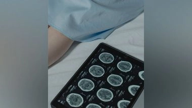 Health News | Study Shows Machine Learning Can Predict Development of Brain Tumours