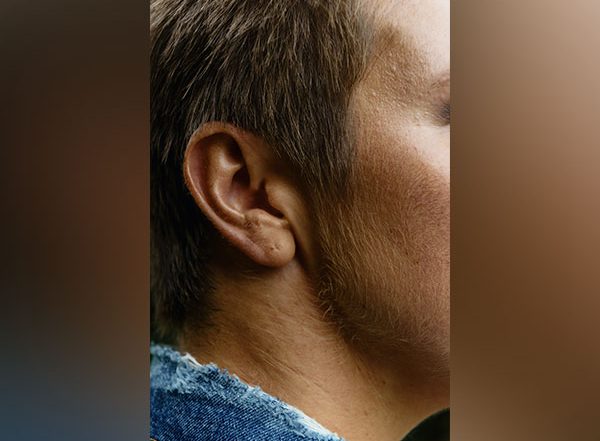 Science News | Research Sheds Light on Organs of Innermost Ear Which Sense Head Position
