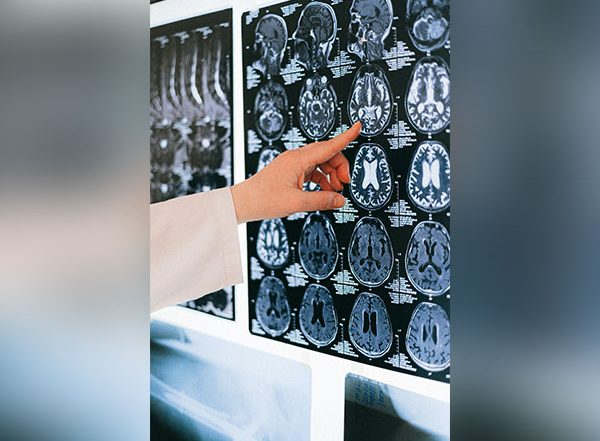 Traffic Pollution Affects Brain Function, Says Study
