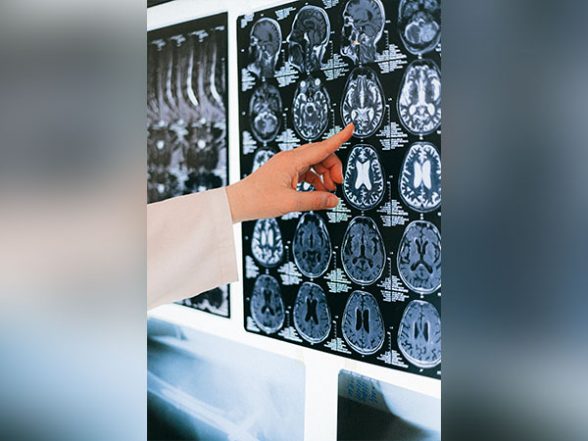 Science News | Study Suggests Brief Exposure to Air Pollution Has Rapid Impacts on Brain - Vimarsana News
