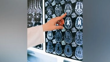 Health News |  Head Injury Associated with Doubled Mortality Rate in Long Term: Study