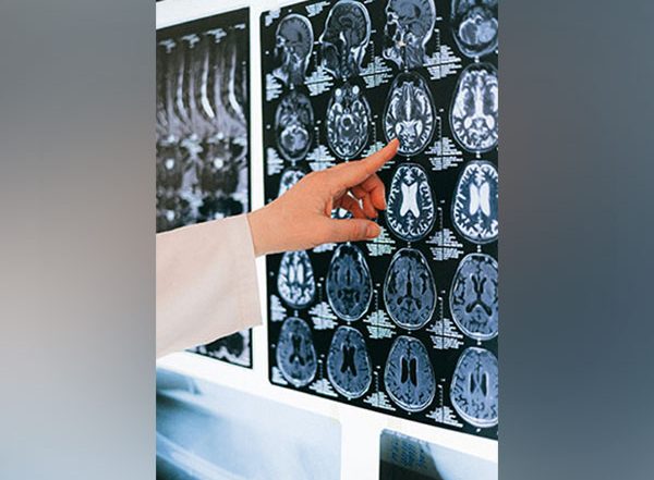 Science News | Is Brain Learning Slower Than Artificial Intelligence? Read on to Know What This Study Says