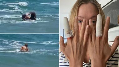 Raised by Wolves Star Loulou Taylor Bitten Six Times in a Seal Attack at Clifton Beach