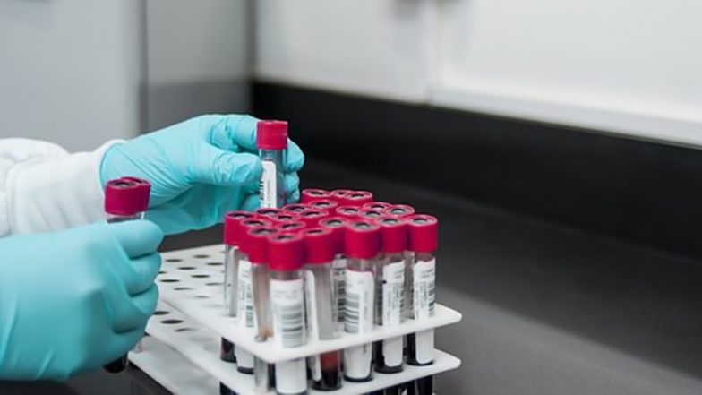 Japan: Harmful Chemicals PFAS Found in Blood of Tokyo Citizens, Says Civic Group