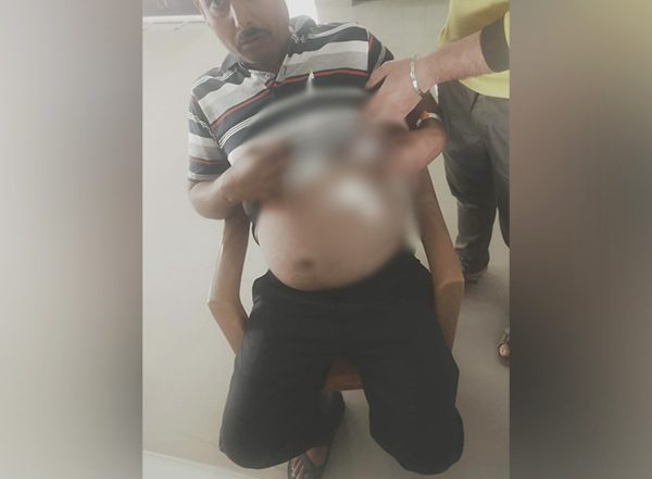 Karnataka Shocker: Man Arrested for Stabbing Colleague After He Refuses To Show His Wife on Video Call In Bengaluru