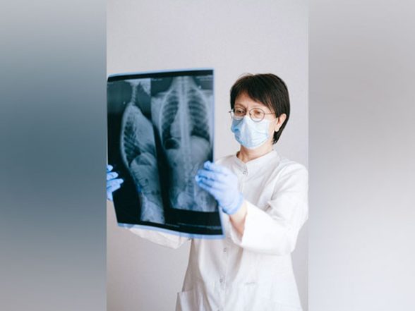 Health News | New Screening Tool Aims to Help in COPD Diagnosis - Vimarsana News