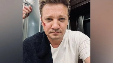 Entertainment News | Jeremy Renner Receiving Electro-therapy Treatment to Recover from Snowplow Accident Injuries