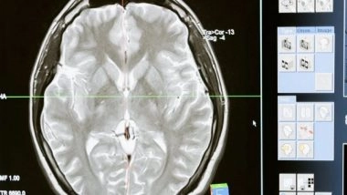 Health News | An Insight into Brain Disorders and Human Cognition