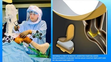 Business News | Mumbai's First Robotic-assisted Partial Knee Replacement Surgery with Gold Coated Implant Led by Dr Santosh Shetty Marks Milestone in Orthopedic Care