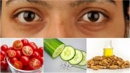 How To Get Rid of Dark Circles Under the Eyes Naturally? Try These Home Remedies To Remove Eye Bags