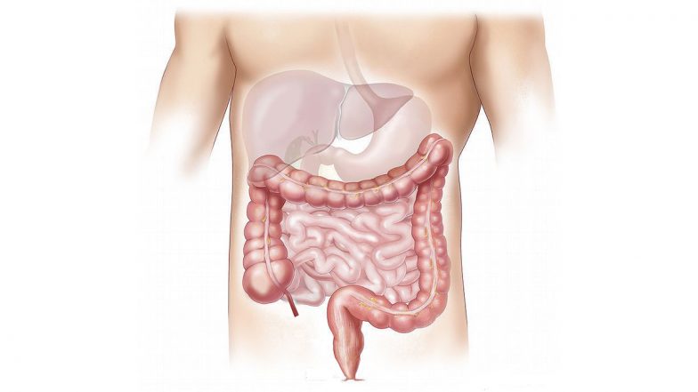 Colorectal Cancer Awareness Month: Medanta Hospital in Gurugram Exhibits First of Its Kind 3D Walkthrough Colon Structure To Teach Timely Intervention