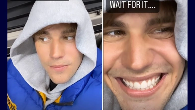 Justin Bieber Looks Fine Now Months After Ramsay Hunt Syndrome Diagnosis (Watch Video)