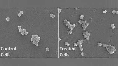 India News | IIT Roorkee Researchers  Discover New Antibacterial Molecule Against Superbugs