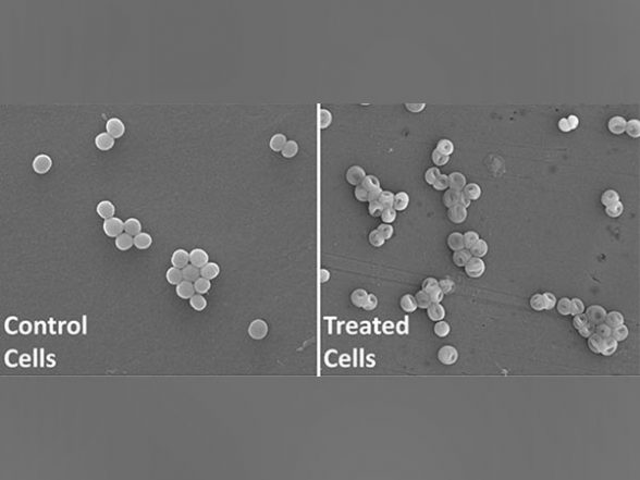 India News | IIT Roorkee Researchers Discover New Antibacterial Molecule Against Superbugs - Vimarsana News