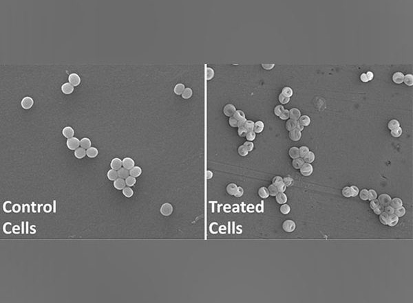 India News | IIT Roorkee Researchers  Discover New Antibacterial Molecule Against Superbugs