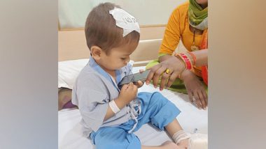 Delhi: Fan Blade Stuck in Two-Year-Old’s Head Removed After Three-Hour Surgery at Private Hospital in Faridabad