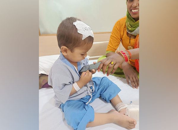 Delhi: Fan Blade Stuck in Two-Year-Old’s Head Removed After Three-Hour Surgery at Private Hospital in Faridabad