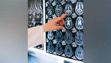 Science News | Study Reveals How Brain Makes Sense of Changing Environmental Cues