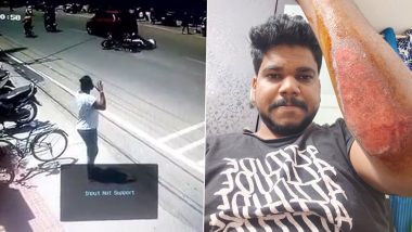 Bengaluru Hit-and-Run Case: Biker, Pillion Rider Suffer Injuries After Car Hits Their Bike, Traffic Police React After Horrific Accident Video Surfaces