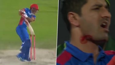 Ouch! Ihsanullah's Fiery Bouncer Leaves Afghanistan's Najibullah Zadran Injured and Bleeding, Causes Him to Retire Hurt During PAK vs AFG 3rd T20I 2023 (See Pics and Video)